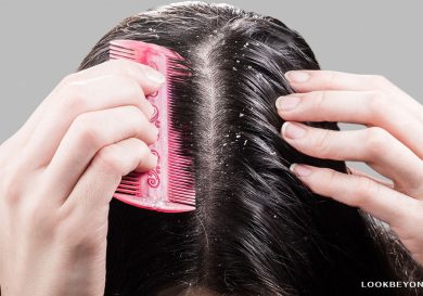 Prevention Tips for Scalp Fungal Infections