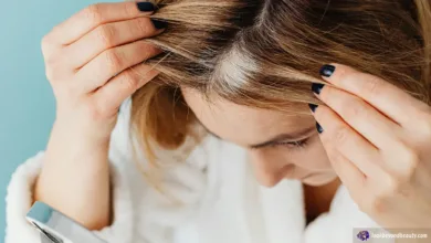 Hidden Causes Of Female Hair Loss | Marcey Grant, Look Beyond Beauty