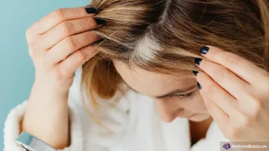 Different Types of Alopecia | Marcey Grant, Look Beyond Beauty