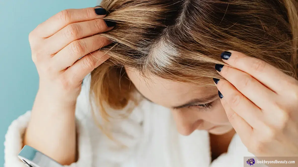 Different Types of Alopecia | Marcey Grant, Look Beyond Beauty